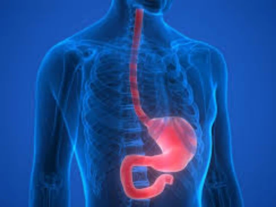 esophageal disorders