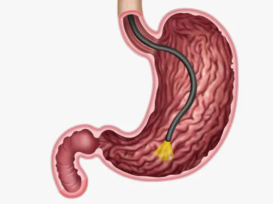 Pancreatitis-Acute-&-Chronic