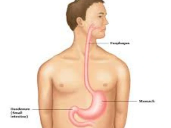 upper gi bleeding